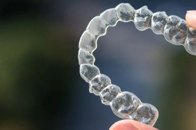 Invisalign: come funziona, quanto dura e cosa aspettarsi